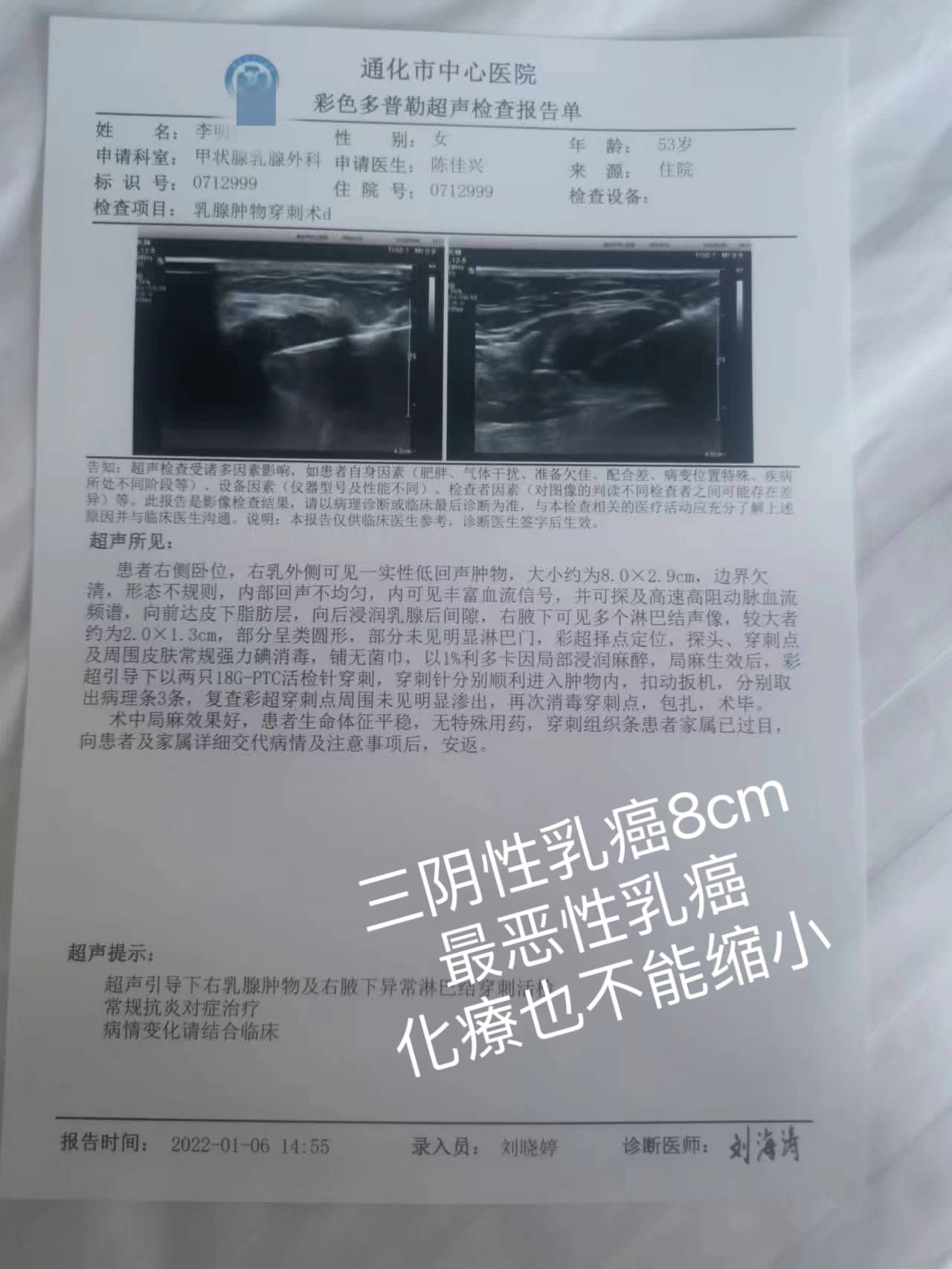 癌症